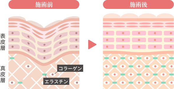 肌の図